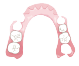 ミラクルデンチャー